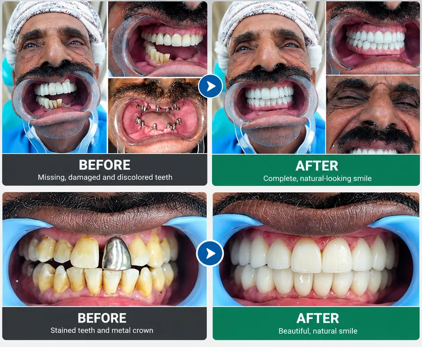 Dr. Anika Bhasin Arora — Root Canal Specialist & Aesthetic Dentist
